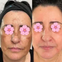 ضد لک قوی اورجینال با٪60درصد تخفیف تاخر امشب