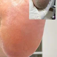 اموزش حرفه پدیکور خشک و خیس|خدمات آموزشی|یزد, |دیوار