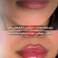 لیزرمو رفع تتوهایفو فیشال فیلربوتاکس لاغری آموزش|خدمات آرایشگری و زیبایی|فردیس, فردیس|دیوار