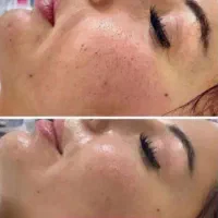 فشیال و تمامی خدمات پوستی