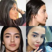 جشنواره تابستانه عمل بینی فقط۳۵تومان|خدمات زیبایی و سلامت|تهران, فردوس|دیوار