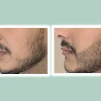 فوری پرش کن