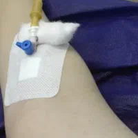 تزریقات در منزل