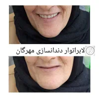 دندانسازی مهرگان(اقساط)