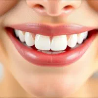 لمینت دیجیتال