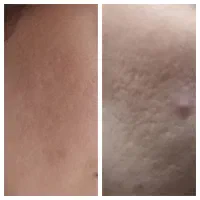 جشنواره یلدایی فیشال تخصصی و درمانی