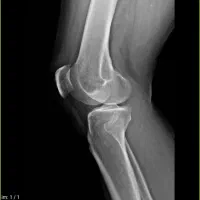 گمشده پرونده آزمایش وبرگه پذیرش