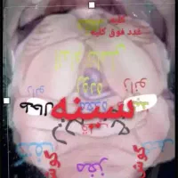 آموزش طب سنتی مخصوص بانوان
