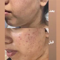 آموزش صفرتاصد پاکسازی وفیشال بامدرک(تخفیف جشنواره|خدمات آموزشی|شیراز, فرهنگ شهر|دیوار