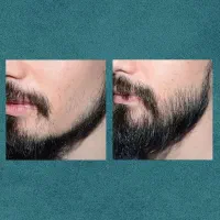 تیغ نزن|آرایشی، بهداشتی، درمانی|یاسوج, |دیوار