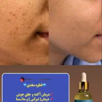 رف انواع لک و کک ومک (لکه بر معروف جهانی فرانسوی)|آرایشی، بهداشتی، درمانی|تهران, زعفرانیه|دیوار