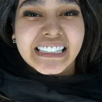 کامپوزیت باکیفیت طرح لمینت تخفیف ویژه عیدانه