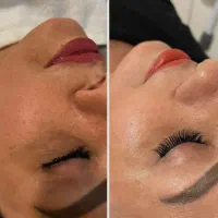 پاکسازی صورت