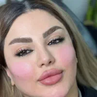 اف یلدایی ژل و بوتاکس