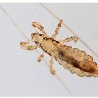 پاکسازی مو سر