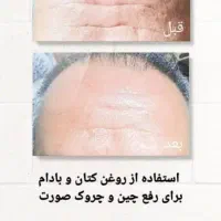 اگهی‌‌روغن‌درمانی