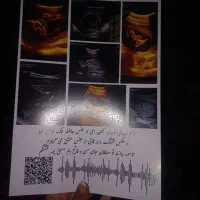 اویز هدیه با طرح دلخواه شما برای کادو و سوپرایز|بدلیجات|کرمان, |دیوار