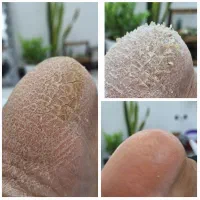 دکتر پا ،درمانگر ناخن و پوست|خدمات آرایشگری و زیبایی|یاسوج, |دیوار