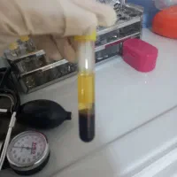 پی ار پی ، فیشال تخصصی، پلاسماژل، بوتاکس