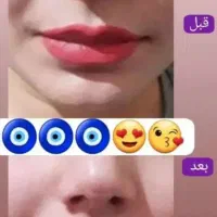 لوسیون لیفت وکوچیک کننده بینی تضمینی وبدون عوارض