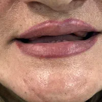 خدمات دندانسازی مروارید