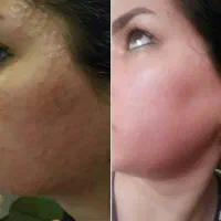 کرم گلدن کویین اصل ضدلک ضدجوشو روشن کننده|آرایشی، بهداشتی، درمانی|بروجرد, |دیوار