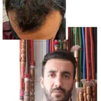 کاشت مو و ابرو هستی..اعظم روستا|خدمات آرایشگری و زیبایی|تهران, کرمان|دیوار