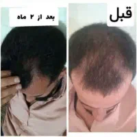 تنها نمایندگی اصلی شامپو مورینگا درتهران|آرایشی، بهداشتی، درمانی|تهران, شهرک رضویه|دیوار