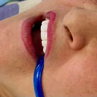کامپوزیت دندانپزشکی تخفیفه ویژه اقساط چکی|خدمات آرایشگری و زیبایی|تهران, شهرک ولیعصر جنوبی|دیوار