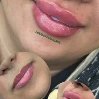 کلینیک زیبایی و لیزر آیسان فیلر و بوتاکس|خدمات آرایشگری و زیبایی|قم, دروازه چوبی|دیوار