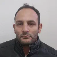 کاشت مو و ابرو|خدمات آرایشگری و زیبایی|قم, پامنار|دیوار