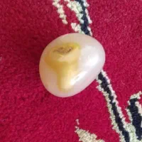 مهره انگشتر قدیمی