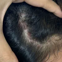تار موت روتا فردا از دست میدی.مگر همین الان بخونی.|خدمات آرایشگری و زیبایی|کرمان, |دیوار