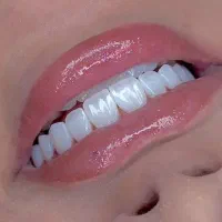 کامپوزیت دندان متریال درجه ۱لبخندلاکچری|خدمات آرایشگری و زیبایی|کرمانشاه, |دیوار