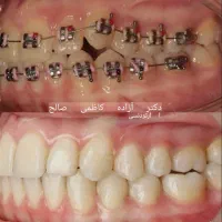 دندانپزشکی اقساطی ارتودنسی ترمیم کامپوزیت ایمپلنت