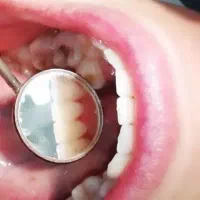 دندانپزشکی قسطی