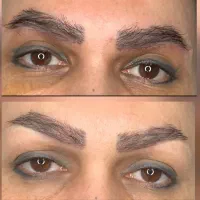 بلفارو غبغب دایرکت پیکر تراشی...توسط پزشک متخصص