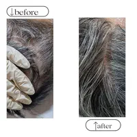 تزریق ژل و بوتاکس، ژل لب روسی و آموزش و ارائه مدرک|خدمات آرایشگری و زیبایی|کرج, شاهین‌ویلا|دیوار