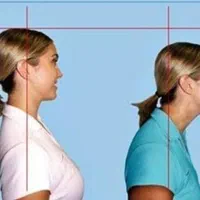 مجموعه تخصصی اصلاح ناهنجاری‌های اسکلتی|خدمات آرایشگری و زیبایی|قزوین, |دیوار