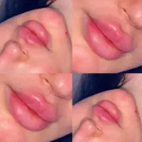 تخفیف‌ژل‌وبوتاکس‌وآموزش‌شهدا