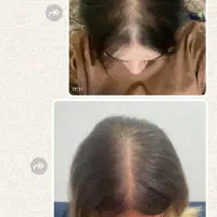 تقویت کننده مو|آرایشی، بهداشتی، درمانی|کاشمر, |دیوار