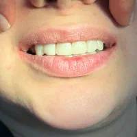 دندانپزشکی با پرداخت یک سوم هزینه