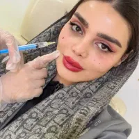 جشنواره بادی/فیلرصورت/ژل لب /جوانساز/ درگلشهر