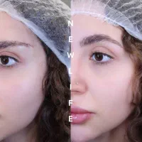 لیفت دائم ابرو ترند این روزها|خدمات زیبایی و سلامت|تهران, شهرک غرب|دیوار