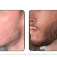 بازی درنیار بیا ریشتو دربیار