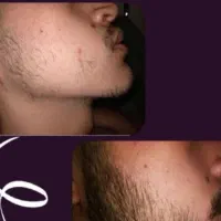 استایل تو با ریش کامل میشه