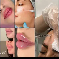 بوتاکس و ژل فیلر و پی آر پی برای خانم ها و آقایان