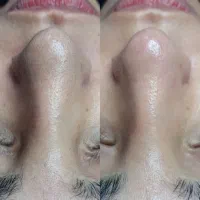 مراقبت پوست تخصصی و حرفه‌ای در عظیمیه