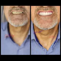 مرکز تخصصی دندانسازی اسپی دنتال|خدمات آرایشگری و زیبایی|خرمآباد, |دیوار