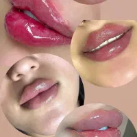 جراحی اسلیو معده بینی لیپو فیلر لب زاویه مزو صورت